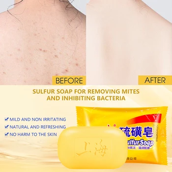 شنغهاي صابون الكبريت 85 غ القديمة العلامة التجارية شنغهاي الصابون في تنظيف الوجه, غسل الوجه, الاستحمام والاستحمام الصابون